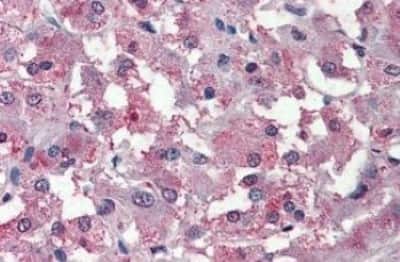 Immunohistochemistry-Paraffin: THEM6 Antibody [NBP3-14494] - THEM6 antibody IHC of human adrenal. Immunohistochemistry of formalin-fixed, paraffin-embedded tissue after heat-induced antigen retrieval.